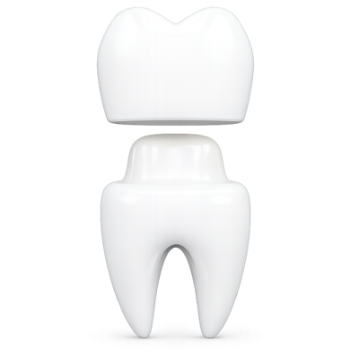 Установка временной коронки