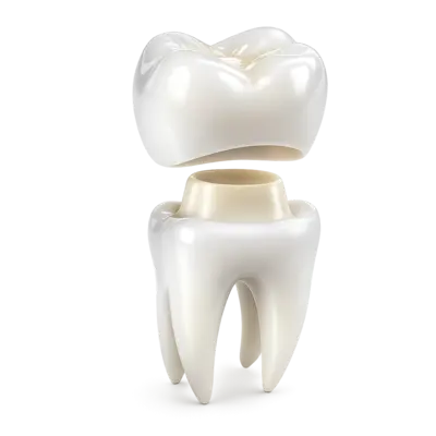 Надёжная фиксация