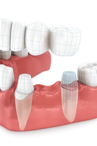 Контроль качества и примерка