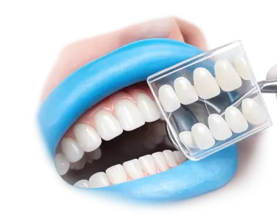 Индивидуальный подбор