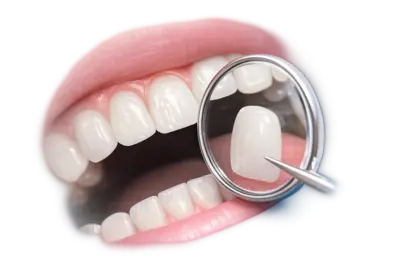 Контроль и долговечность