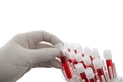 Лабораторные анализы крови