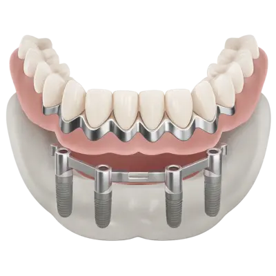 Керамокомпозит