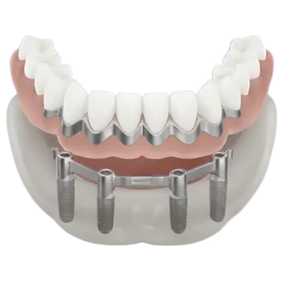 Диоксид циркония