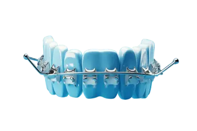 Высококачественные брекет-системы от официальных производителей