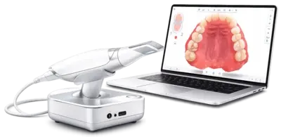 Сверхточные цифровые слепки без неприятных ощущений