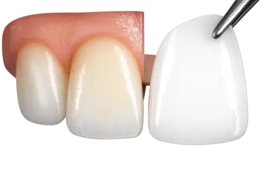 Точная примерка и фиксация