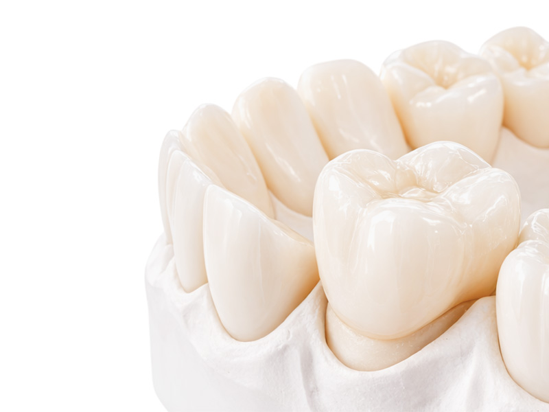 Циркониевая коронка «под ключ»