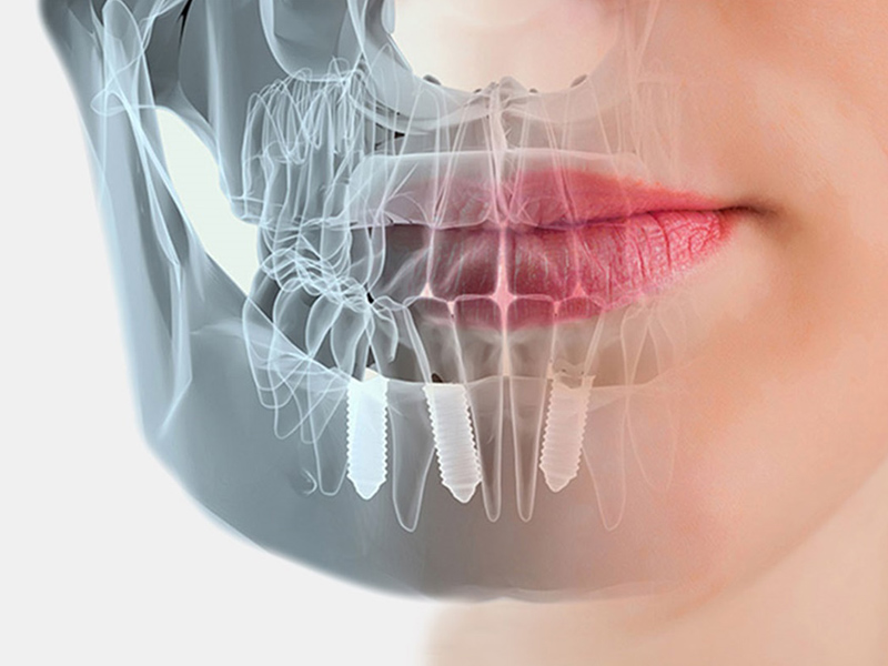 КТ 2х челюстей + консультация стоматолога 2 200 ₽