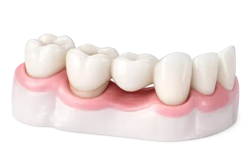 Мост на свои зубы по выгодной цене