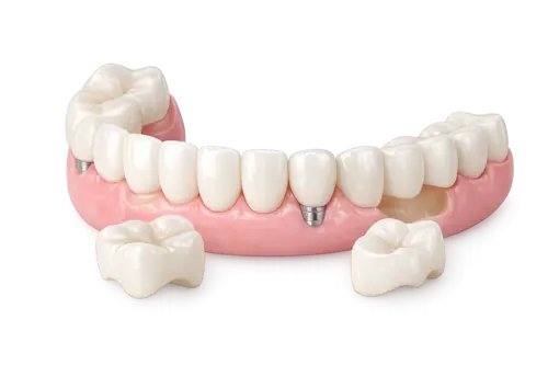 Восстановительная вкладка