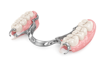 Бюгельный протез в Москве