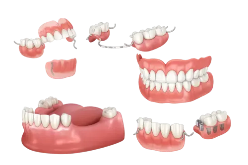 Съёмные протезы