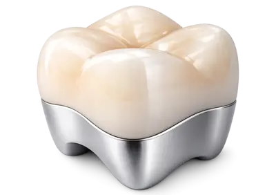 Металлопластмассовая коронка