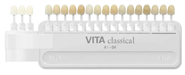 цвет виниров в КДС Дентал