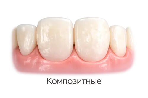 Композитные виниры в Москве