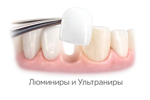 Люминиры в Москве