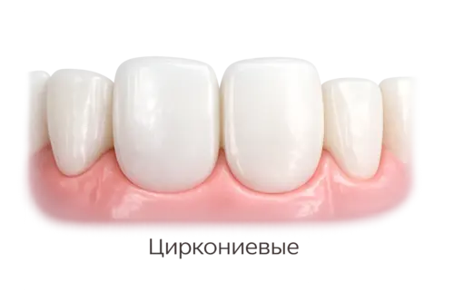 Циркониевые виниры в Москве