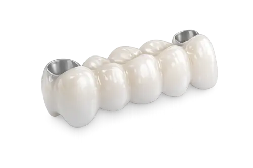 Металлокерамический зубной мост