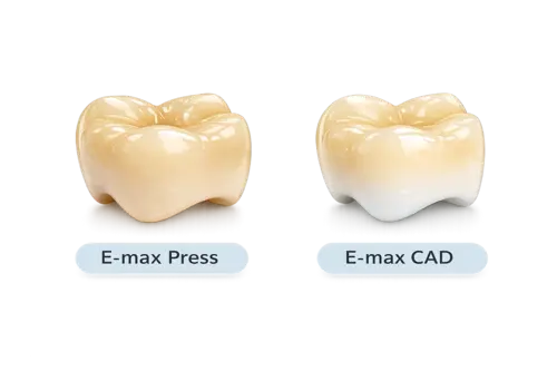 Виды коронок E-max в КДС Дентал