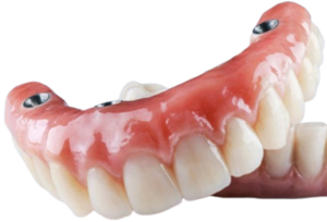 Съёмные протезы