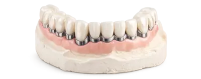 Металлокерамические коронки