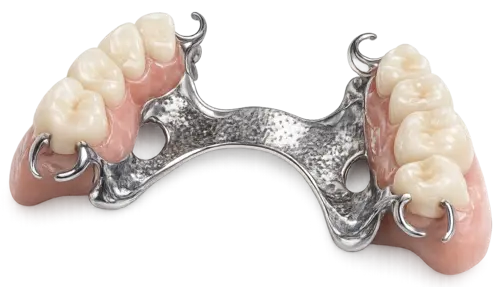 Съёмное протезирование