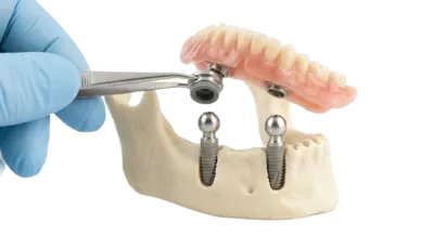 Шаровидные протезы