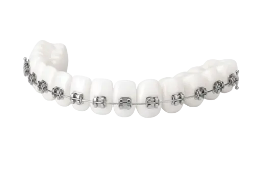 Металлические