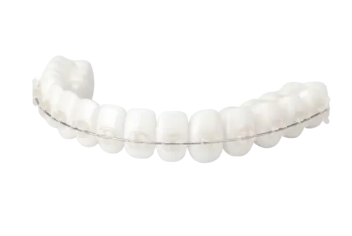 Керамические