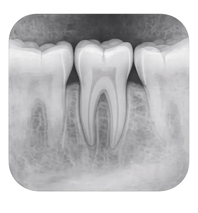 Виды прицельных рентген-снимков в Москве