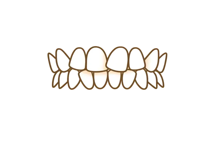 Исправить скученность зубов с элайнерами в Москве