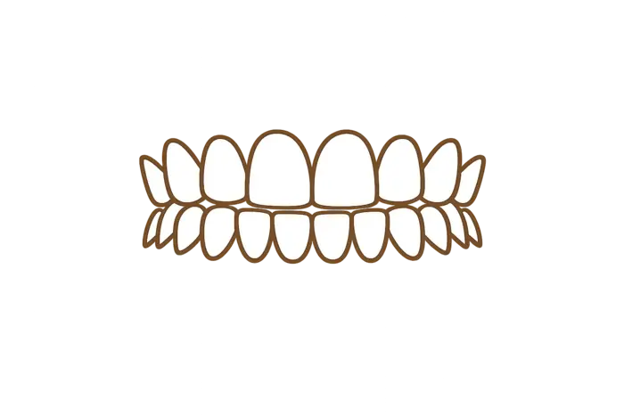 Исправление в САО Москвы элайнерами открытого прикуса