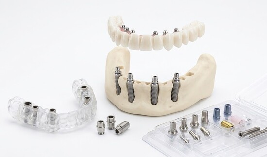 протезирования All-on-6