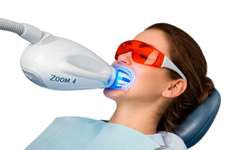 Отбеливание зубов Zoom 4 в Москве