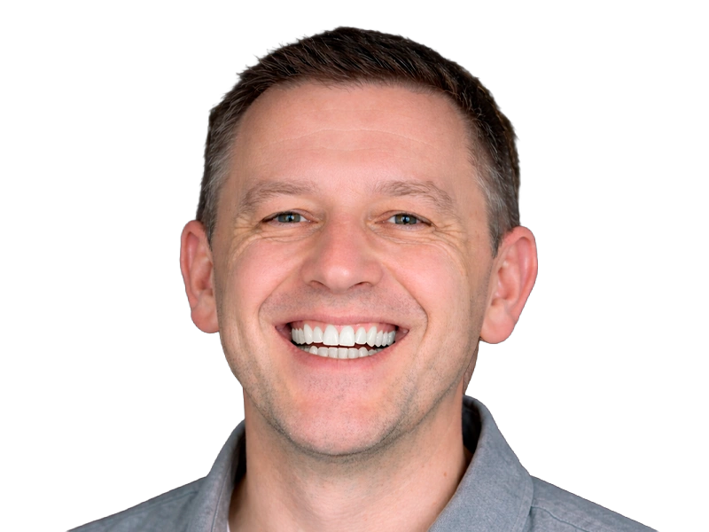 Полная реабилитация зубов на имплантах All-on-6 при тяжёлом пародонтите