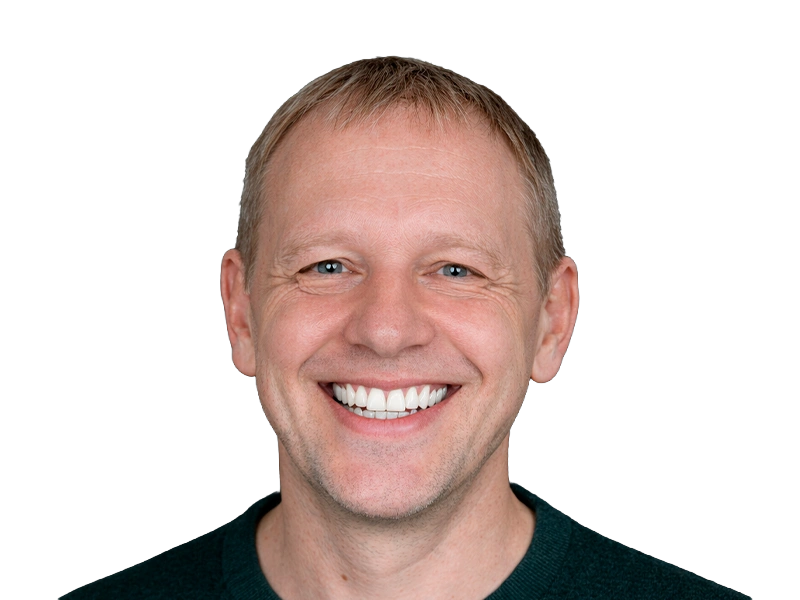 Восстановление верхней челюсти на имплантах All-on-4: возвращение жевательной функции и красивой улыбки