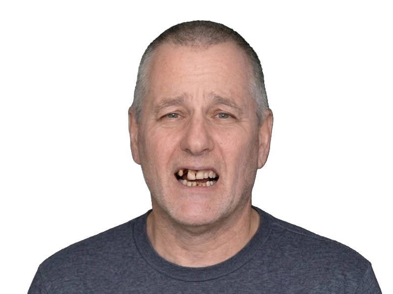 До