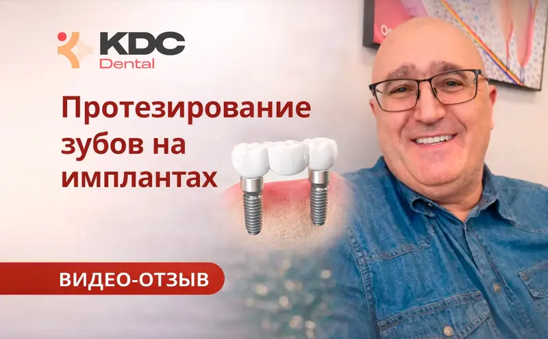 Картинка обложки отзыва